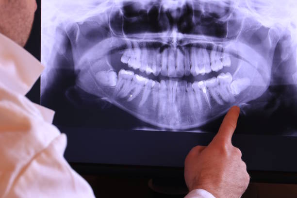 Best Mobile Emergency Dentist in Rio Bravo, TX