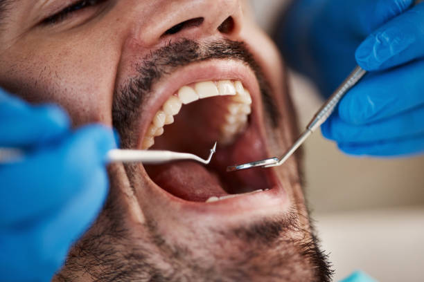 Best Urgent Dental Care for Toothache in Rio Bravo, TX