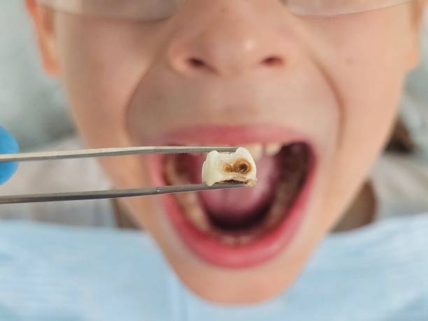 Best Pediatric Emergency Dentist in Rio Bravo, TX